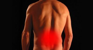 Sciatica