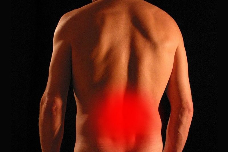 Sciatica
