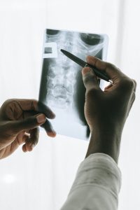 Revision Spine Surgery