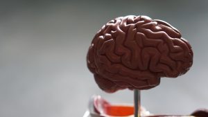 Chiari Malformation