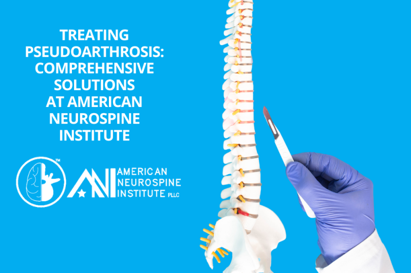 Treating Pseudoarthrosis Comprehensive Solutions at American Neurospine Institute, PLLC 2