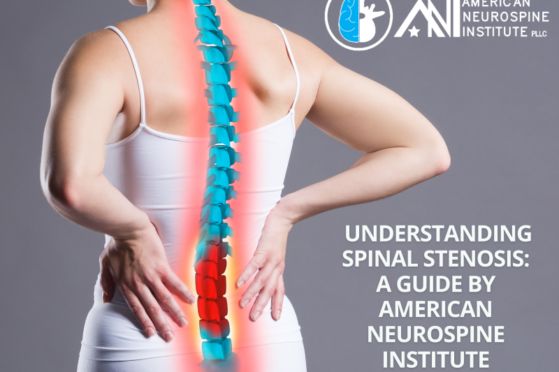 Understanding Spinal Stenosis A Guide by American Neurospine Institute, PLLC 2
