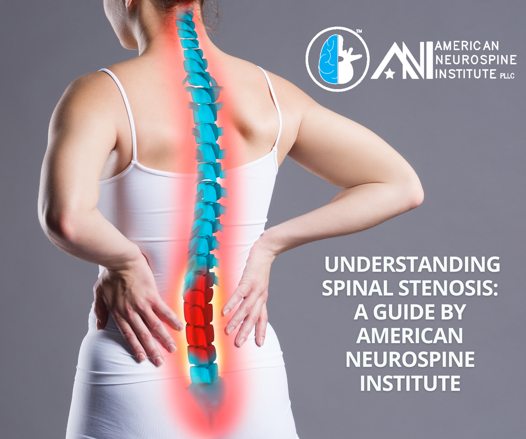 Understanding Spinal Stenosis A Guide by American Neurospine Institute, PLLC 2